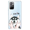 Capa de TPU IMD para Xiaomi Redmi Note 11 Pro/Note 11 Pro+ - Smile