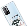 Capa de TPU IMD para Xiaomi Redmi Note 11 Pro/Note 11 Pro+ - Smile